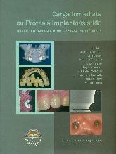 Carga inmediata en protesis implantoasistida