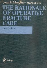 The rationale of operative fracture