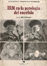 IRM en la patologia del encefalo