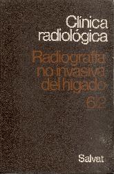 Radiografia no invasiva del Higado