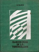 Radiologia de la tuberculosis