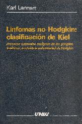 Linfomas No Hodgkin: