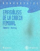 Epifisiolisis de la cabeza femoral