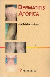 Dermatitis atopica