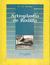 Artroplastia de la rodilla