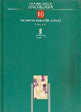 Leucemia mieloide cronica 10