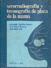 Xerorradiografia y termografia de placa de la mama