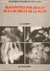 Diagnstico por Imagen Mueca y Mano