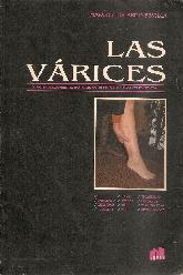 Las Varices