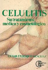 Celulitis Su tratamiento medico y cosmetologico