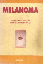 Melanoma