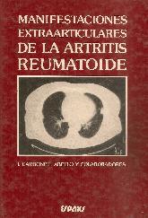 Manifestaciones extraarticulares de la artritis reumatoide