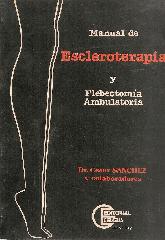 Escleroterapia y flebectoma ambulatoria Manual