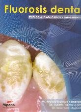 Fluorosis dental