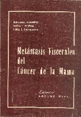 Metastasis viscerales del cancer de la mama