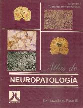 Atlas de Neuropatologia Vol I Tumores Intracraneanos