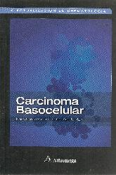 Carcinoma Basocelular