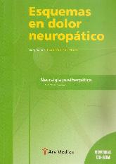 Esquemas de Dolor Neuropatico