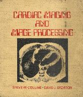 Cardiac imaging and image processing