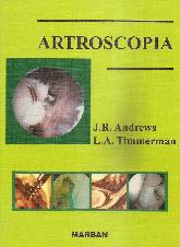 Artroscopia