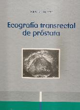 Ecografia transrectal de prostata