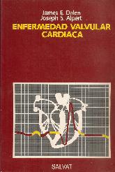 Enfermedad valvular cardiaca