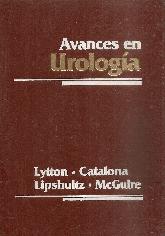 Avances en urologia