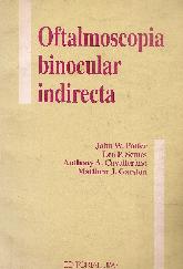 Oftalmoscopia binocular indirecta