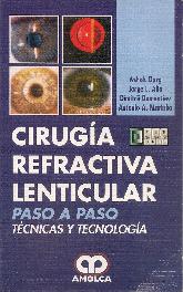 Ciruga Refractiva Lenticular