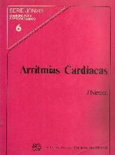 Arritmias Cardiacas