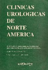 Deteccion y tratamiento tempranos del carcinoma localizado de prostata