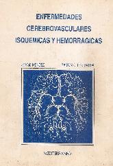 Enfermedades cerebro vasculares isquemicas y hemorragicas