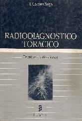 Radiodiagnostico toracico