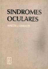 Sindromes Oculares