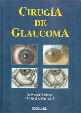 Cirugia de glaucoma