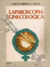 Laparoscopia ginecologica