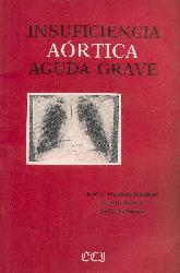 Insuficiencia aortica aguda grave