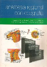 Anestesia regional con ecografa