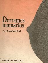 Derrames mamarios