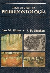 Atlas en color de Periodontologia