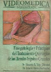 VIDEO Fisiopatologia y principios del tratamiento quirurgico de las hernias inguino-crurales -VIDEO-