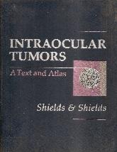 Intraocular tumors