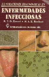 Ilustraciones diagnosticas en enfermedades infecciosas