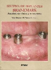Sistema de implantes Branemark