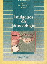Imagenes en Ginecologia