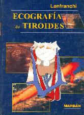 Ecografia de tiroides