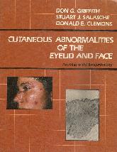 Cutaneus Abnormalities of the Eyelid and face