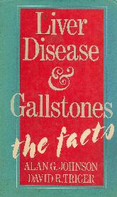 Liver Disease and gallstones the facts