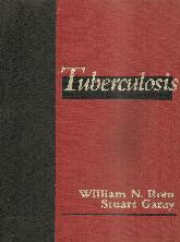 Tuberculosis