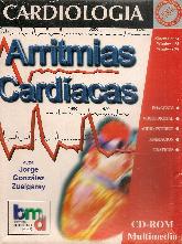 Arritmias cardiacas CD